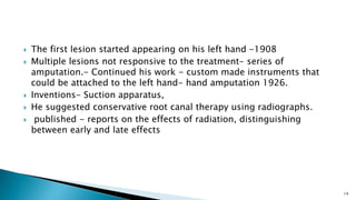  The first lesion started appearing on his left hand -1908
 Multiple lesions not responsive to the treatment- series of
amputation.- Continued his work - custom made instruments that
could be attached to the left hand- hand amputation 1926.
 Inventions- Suction apparatus,
 He suggested conservative root canal therapy using radiographs.
 published - reports on the effects of radiation, distinguishing
between early and late effects
14
 