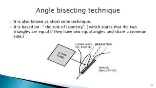  It is also known as short cone technique.
 It is based on- “ the rule of isometry”. ( which states that the two
triangles are equal if they have two equal angles and share a common
side.)
28
 