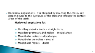  Horizontal angulations- it is obtained by directing the central ray
perpendicular to the curvature of the arch and through the contact
areas of the teeth.
29
Horizontal angulations for:
 Maxillary anterior teeth – straight facial
 Maxillary premolars and molars – mesial angle
 Mandibular incisors – distal angle
 Mandibular premolars – mesial
 Mandibular molars - distal
 