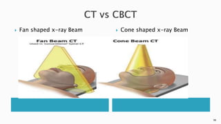  Fan shaped x-ray Beam  Cone shaped x-ray Beam
96
 