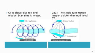  CT is slower due to spiral
motion. Scan time is longer.
 CBCT-The single turn motion
image- quicker than traditional
CT.
99
 