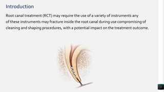 Endodontic instrument fracture and thier management by dr.maryam salman ...