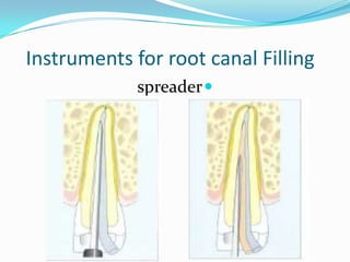 Root Filling Instruments Endodontic instruments | PPTX