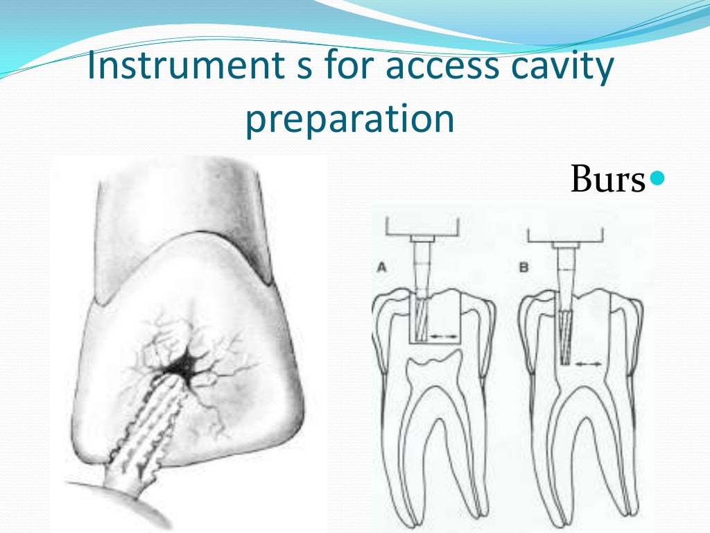 Endodontic instruments