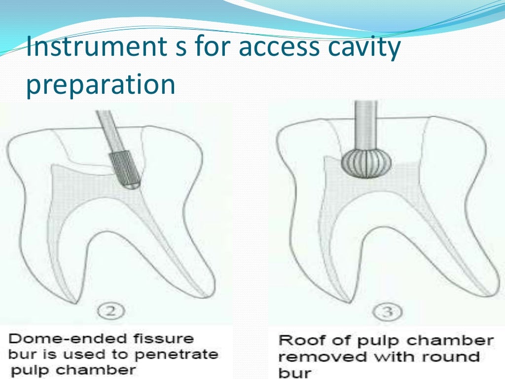 Endodontic instruments