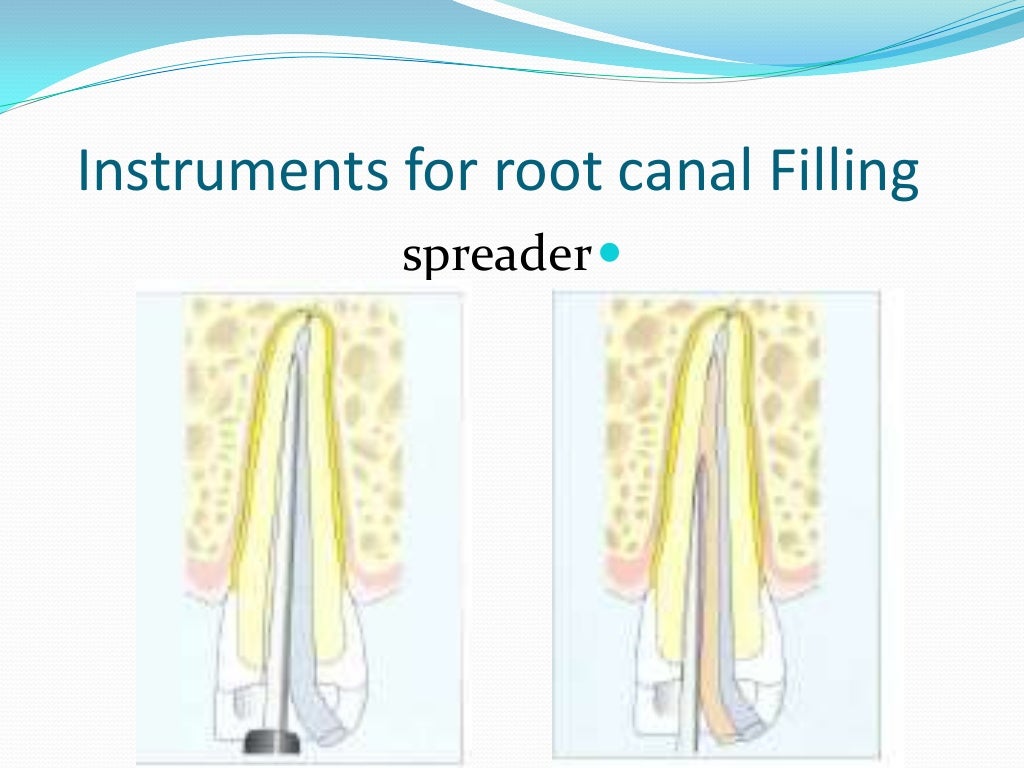 Endodontic instruments