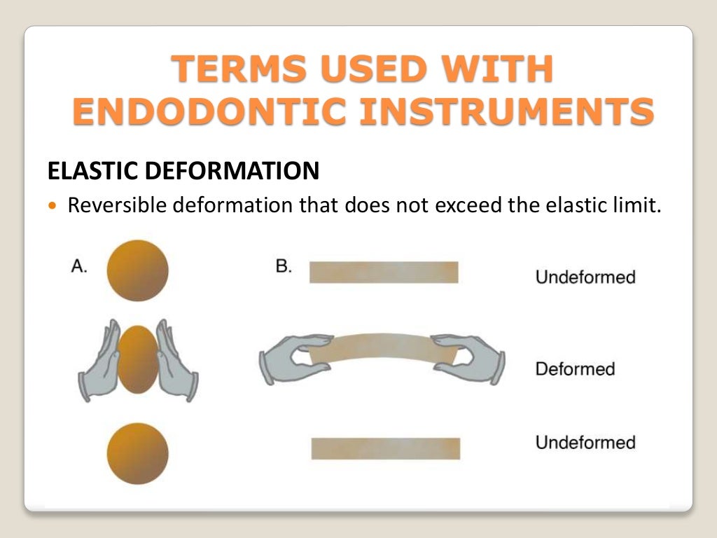 Endodontic instruments
