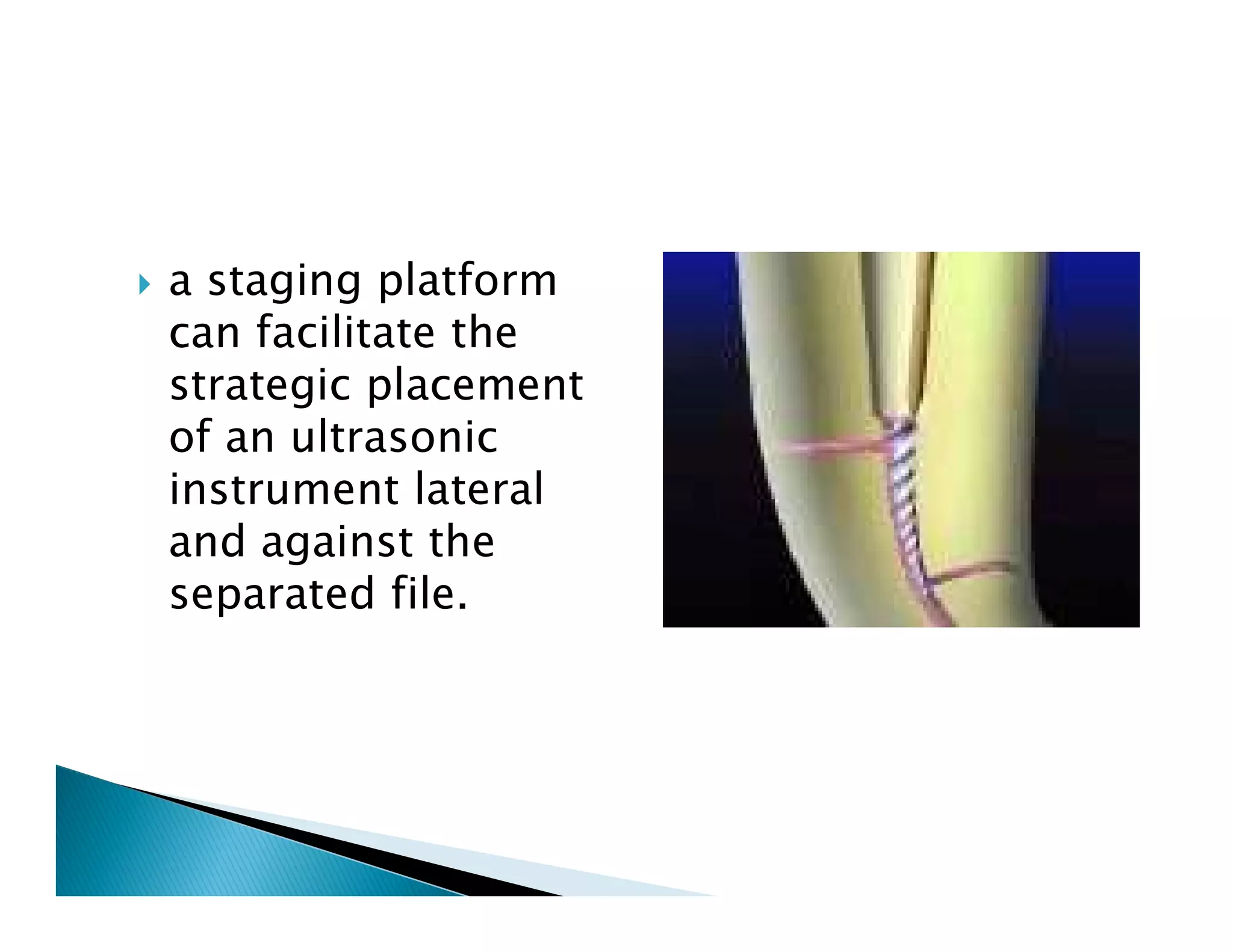 Endodontic instruments