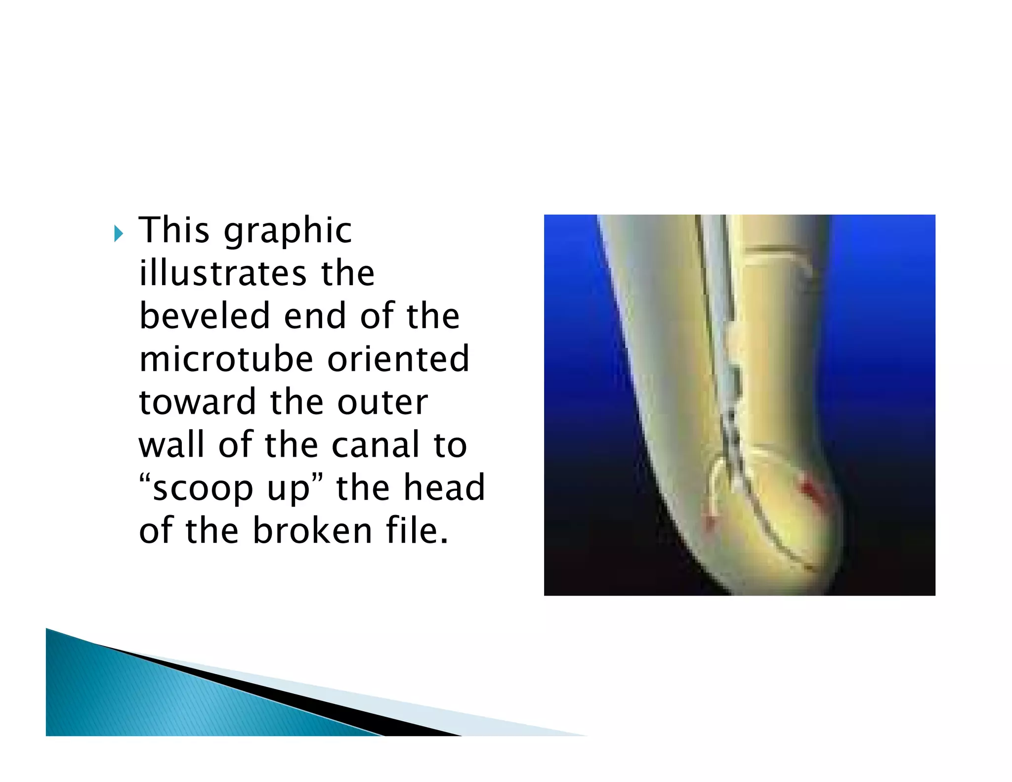 Endodontic instruments