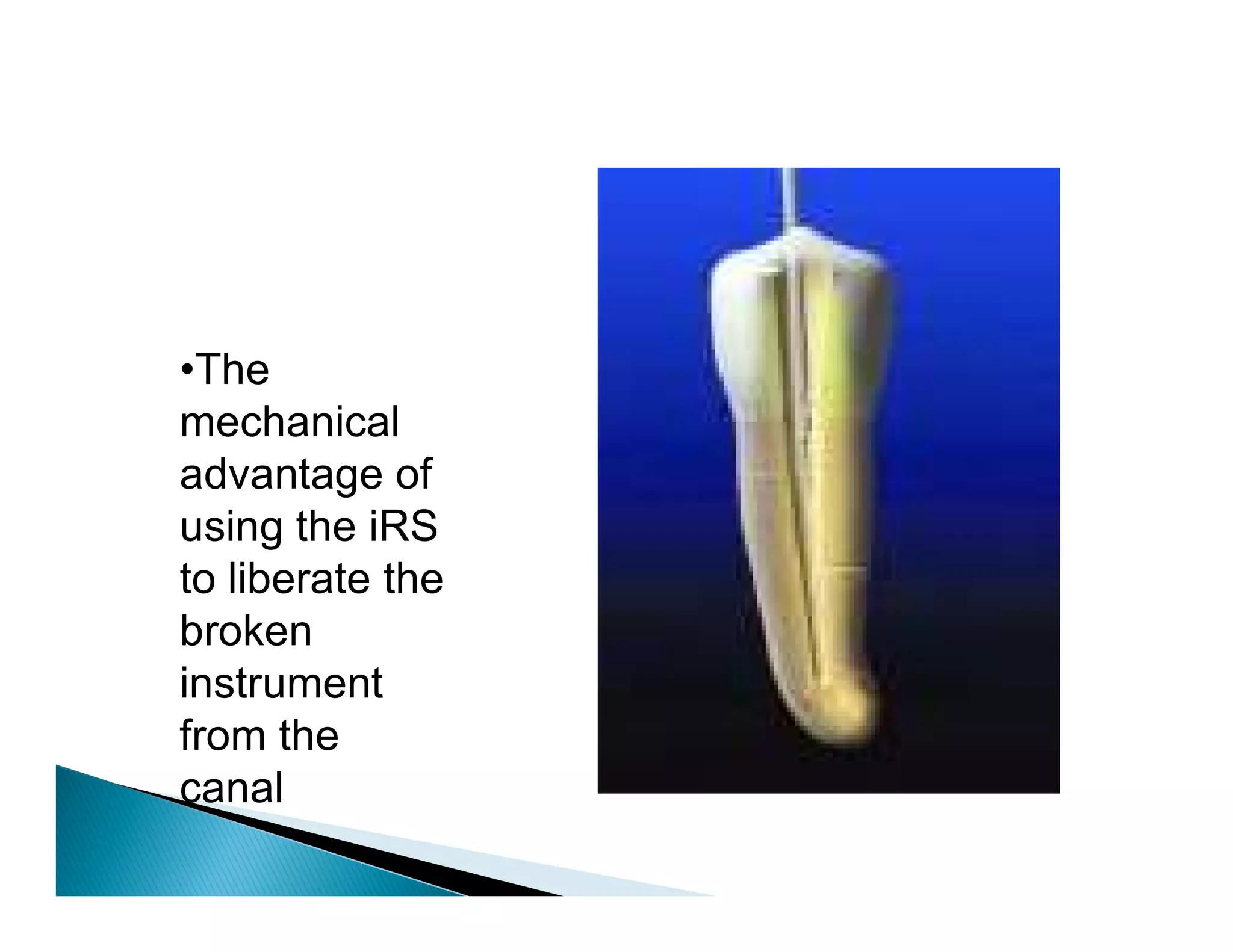 Endodontic instruments