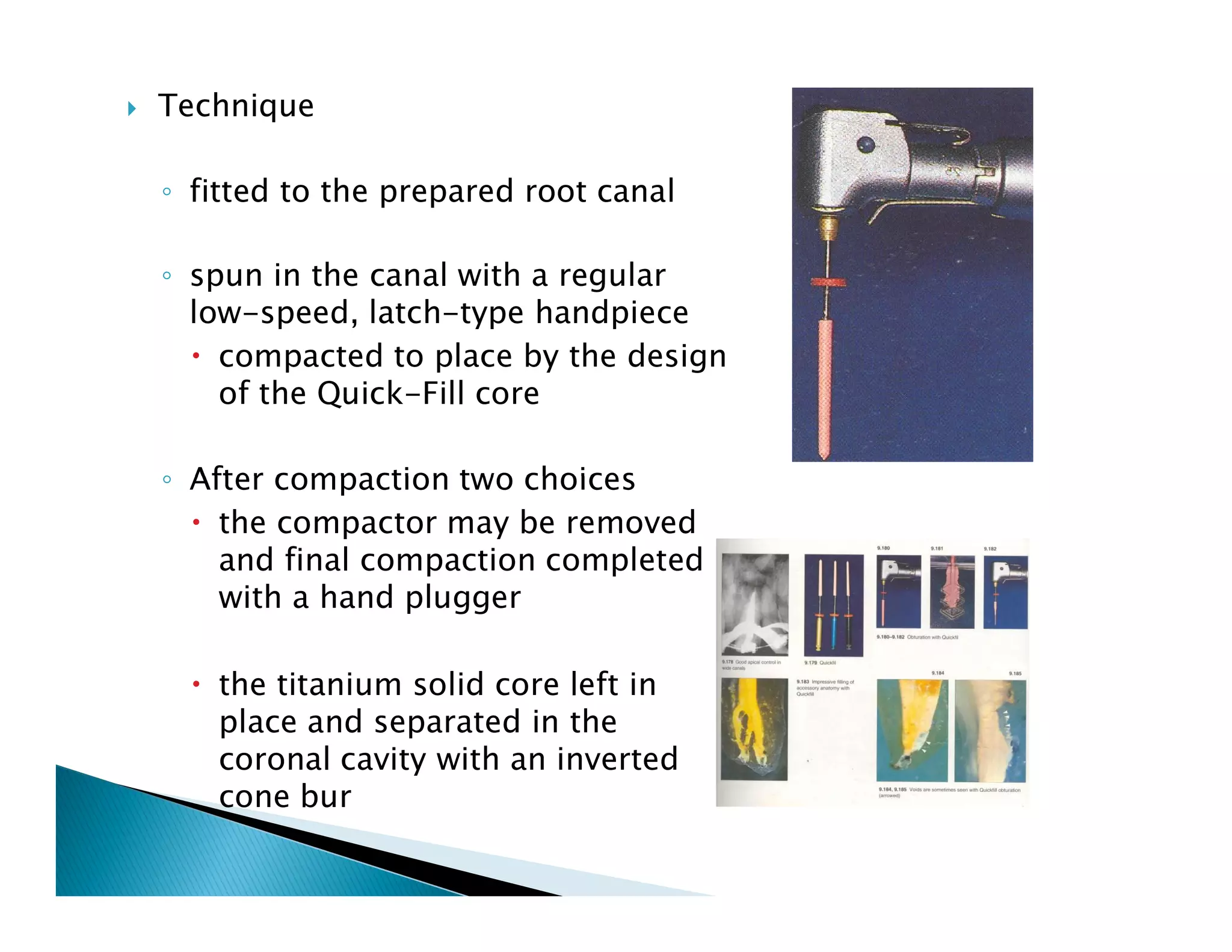 Endodontic instruments