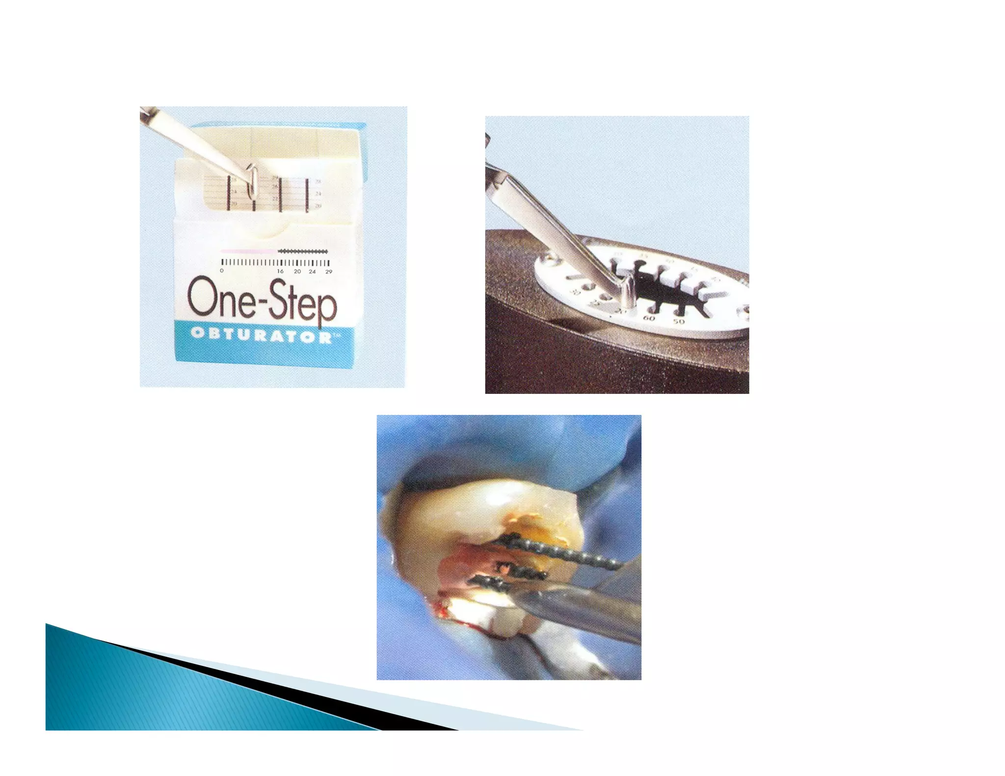 Endodontic instruments