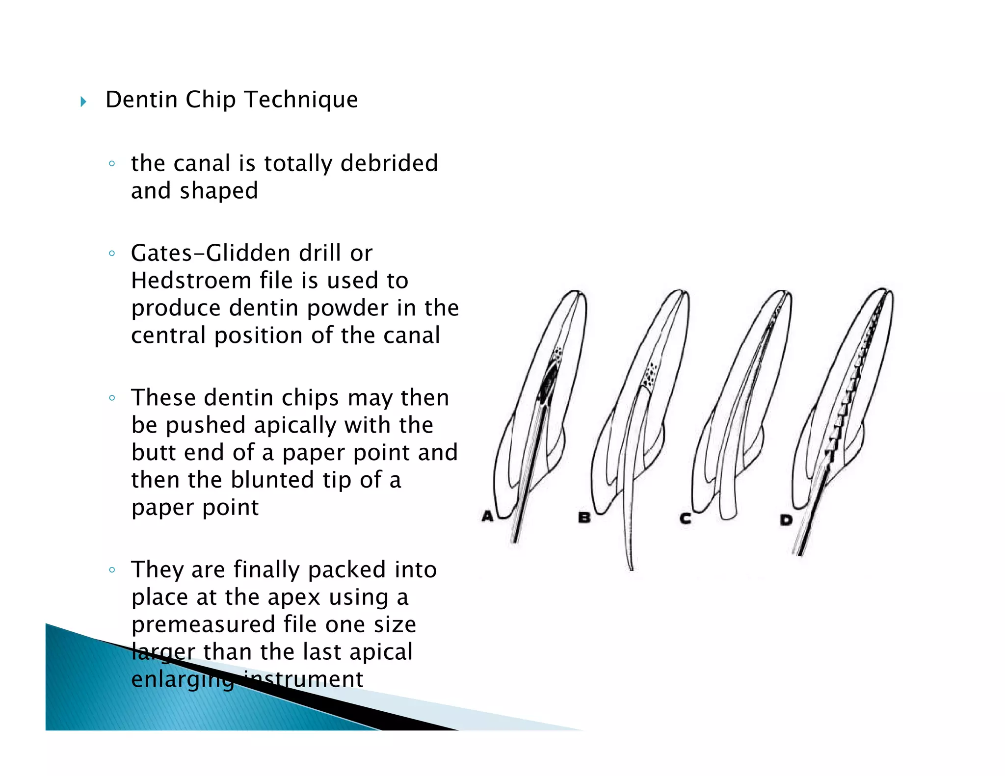 Endodontic instruments