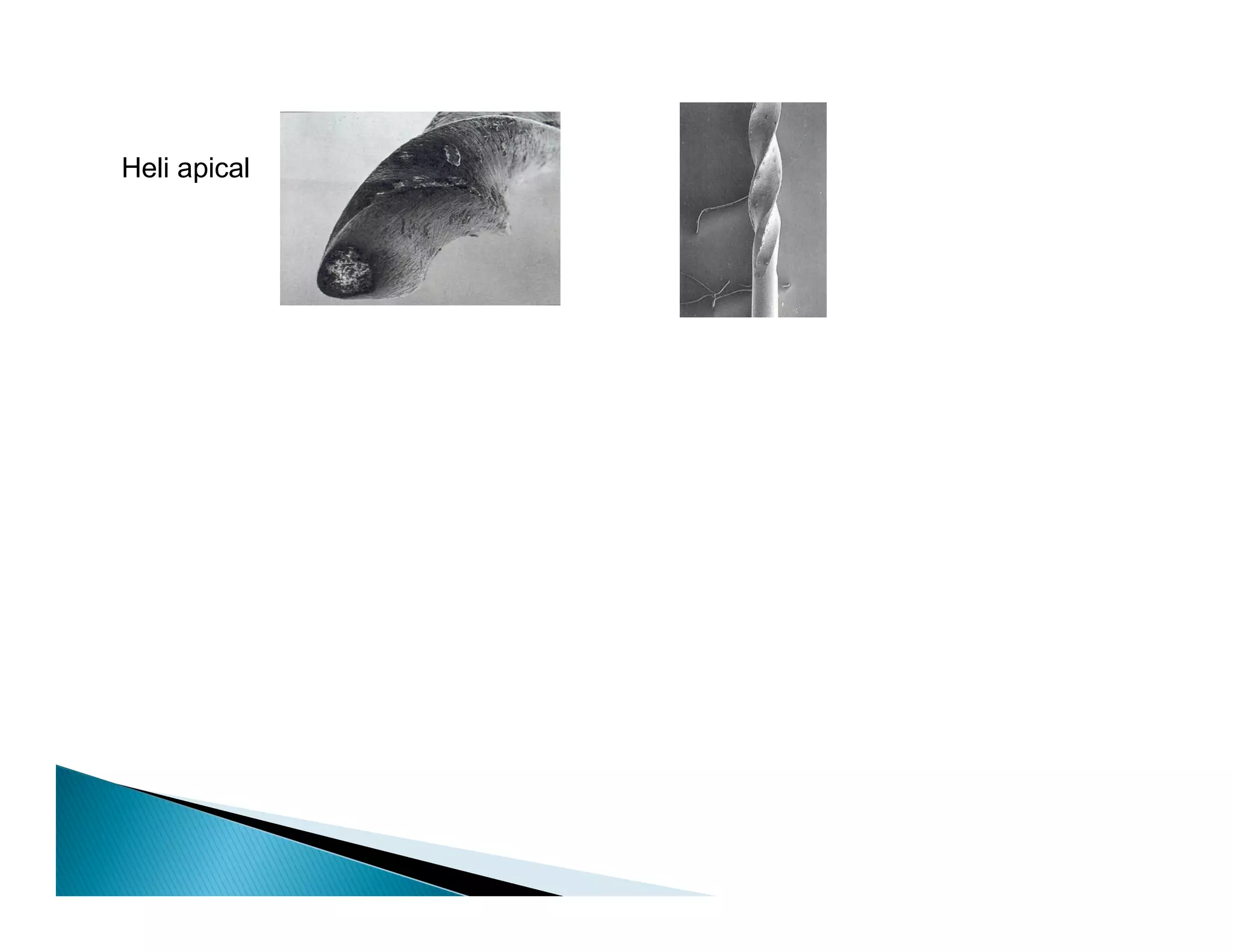 Endodontic instruments