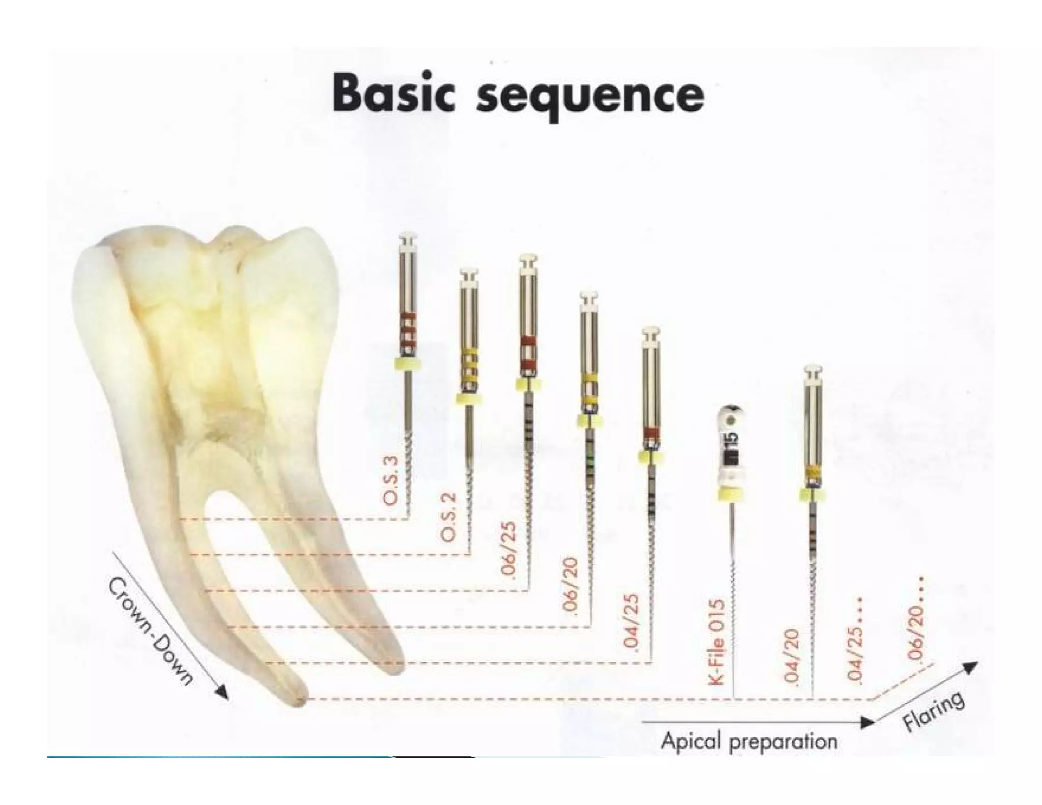 Endodontic instruments