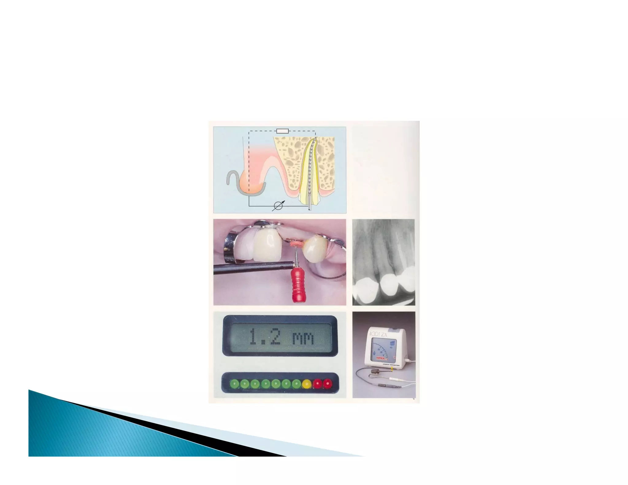 Endodontic instruments