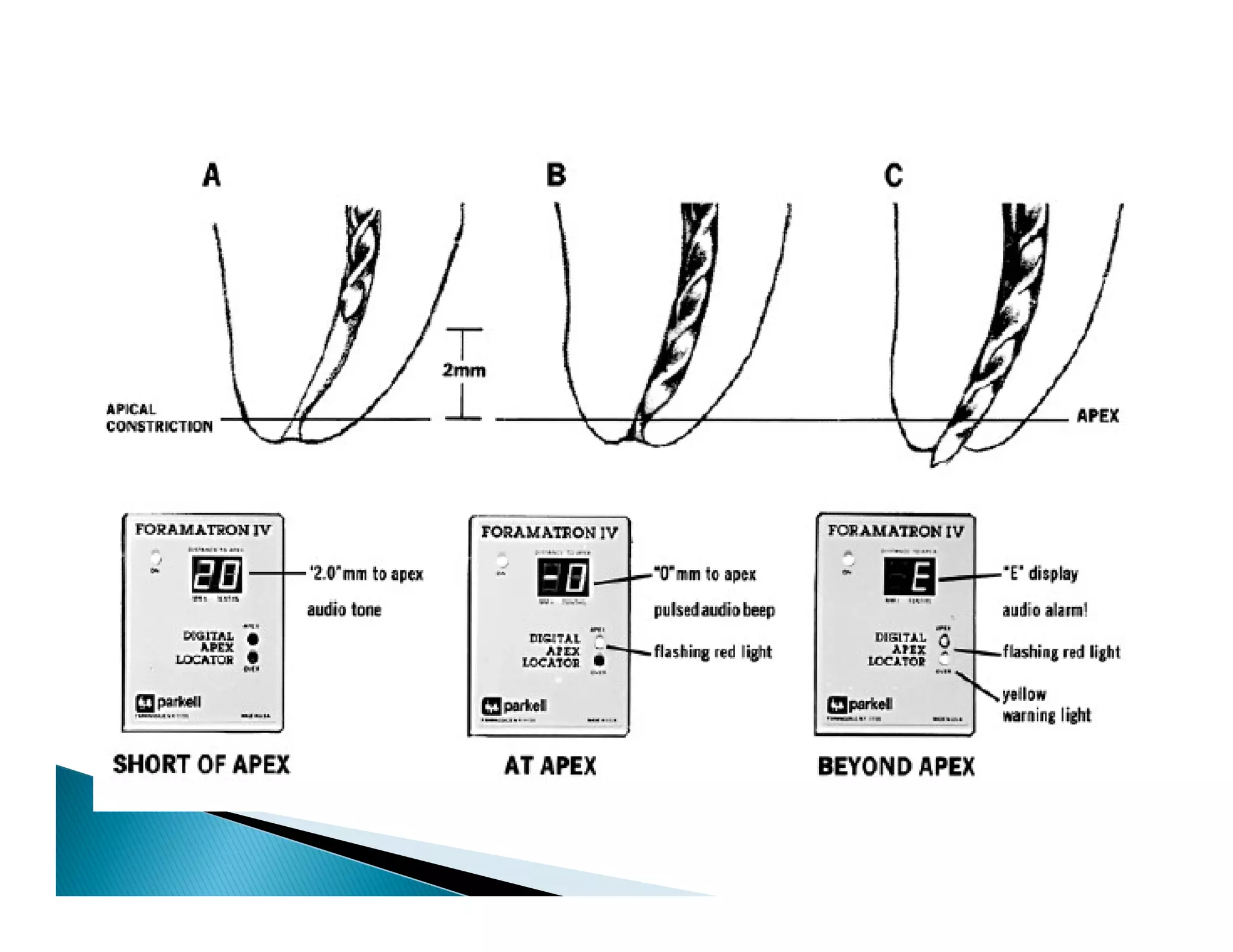 Endodontic instruments