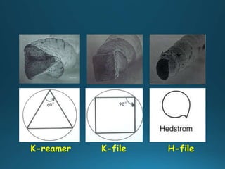 K-reamer K-file H-file
 