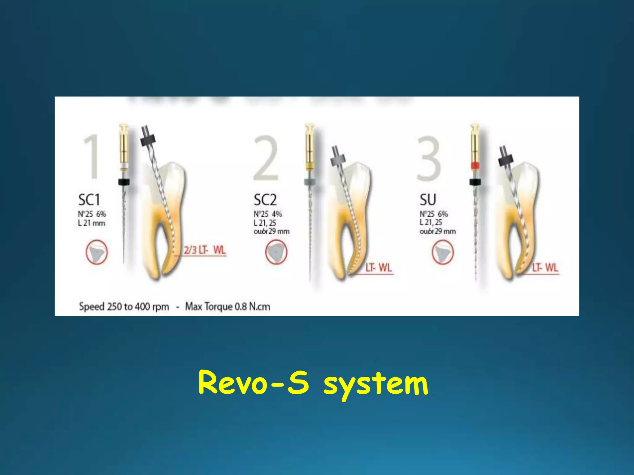 Revo-S system
 