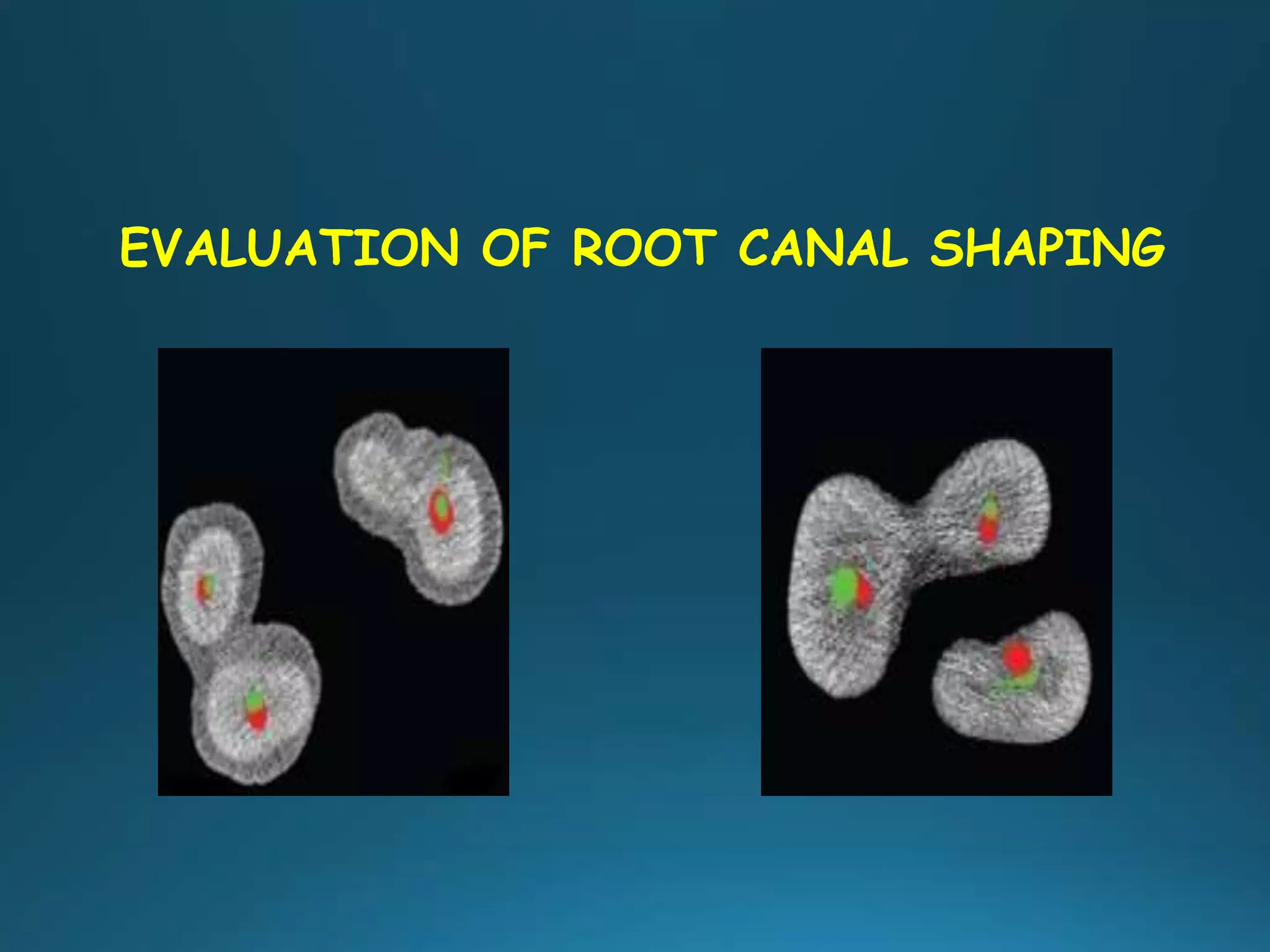 EVALUATION OF ROOT CANAL SHAPING
 