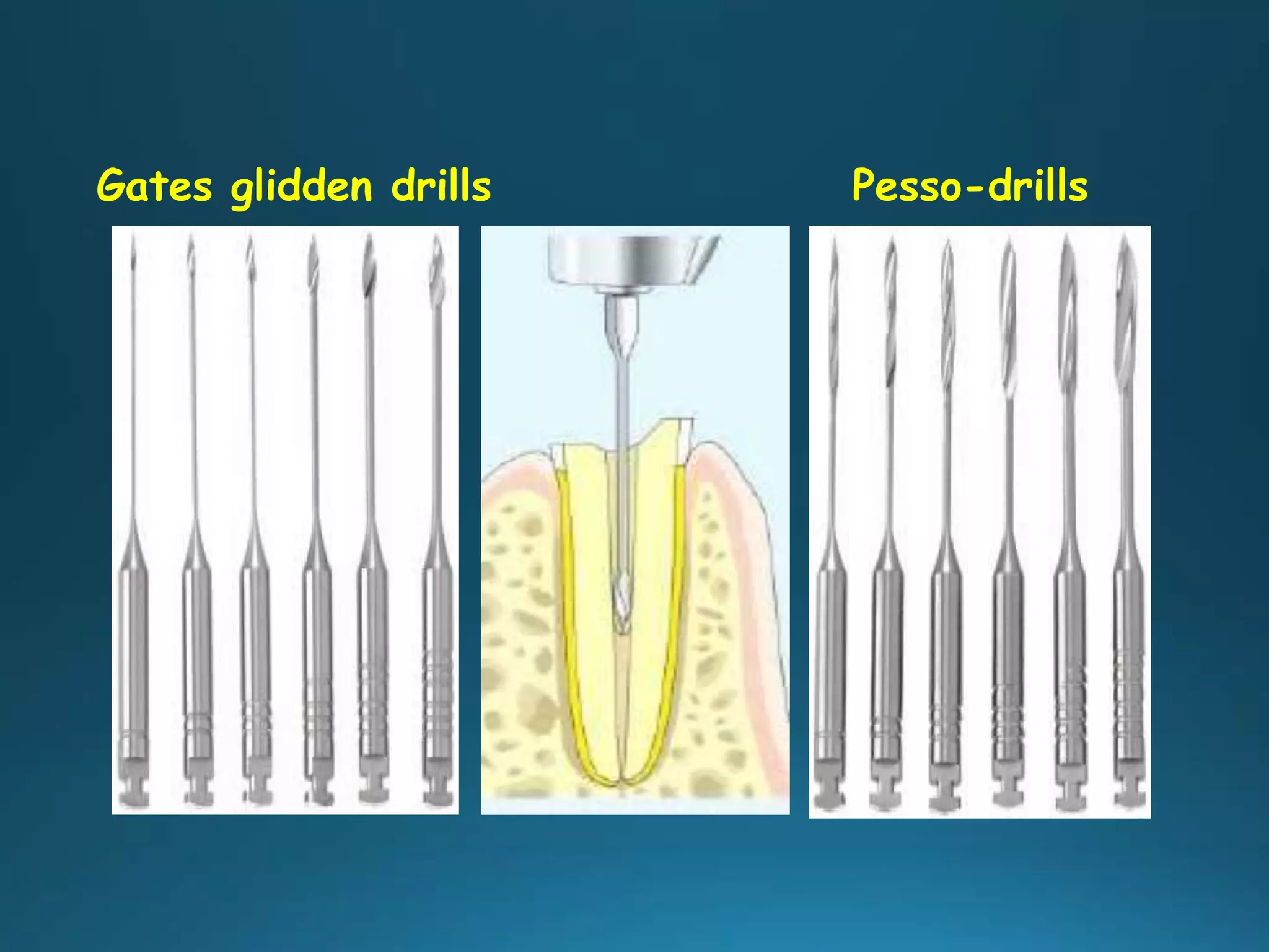 Gates glidden drills Pesso-drills
 