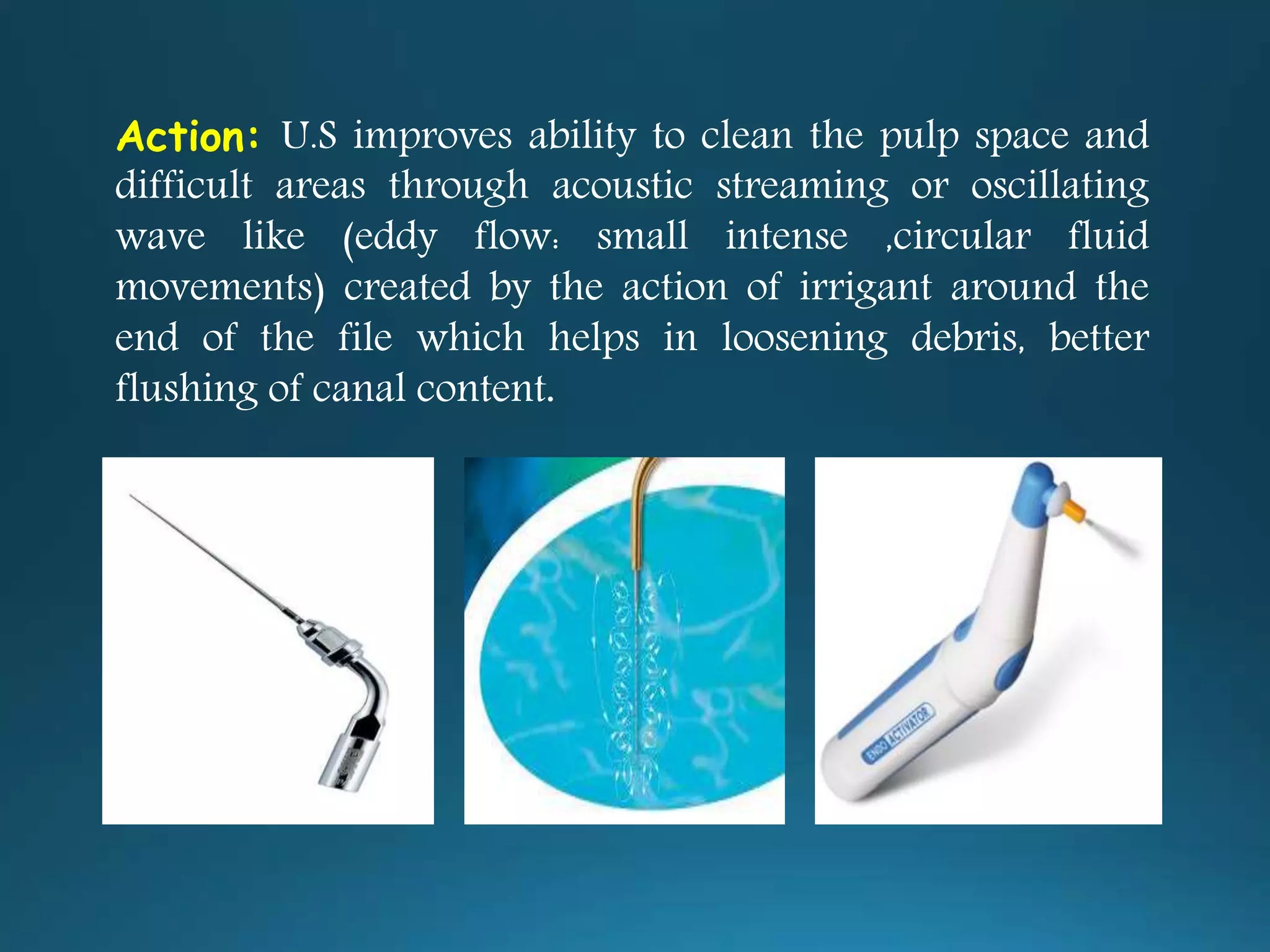 Action: U.S improves ability to clean the pulp space and
difficult areas through acoustic streaming or oscillating
wave like (eddy flow: small intense ,circular fluid
movements) created by the action of irrigant around the
end of the file which helps in loosening debris, better
flushing of canal content.
 