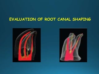 EVALUATION OF ROOT CANAL SHAPING
 