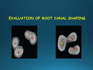 EVALUATION OF ROOT CANAL SHAPING
 
