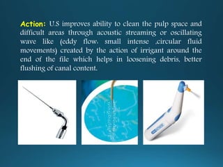 Action: U.S improves ability to clean the pulp space and
difficult areas through acoustic streaming or oscillating
wave like (eddy flow: small intense ,circular fluid
movements) created by the action of irrigant around the
end of the file which helps in loosening debris, better
flushing of canal content.
 