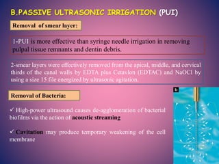 1-PUI is more effective than syringe needle irrigation in removing
pulpal tissue remnants and dentin debris.
2-smear layer...