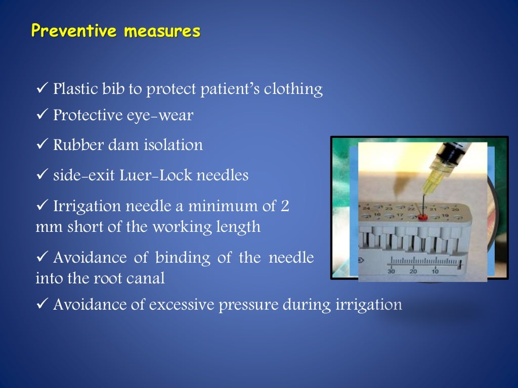 Endodontic irrigating solutions