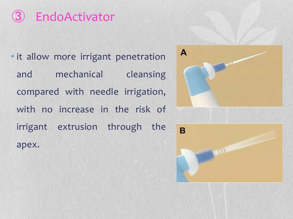 Endodontic irrigation