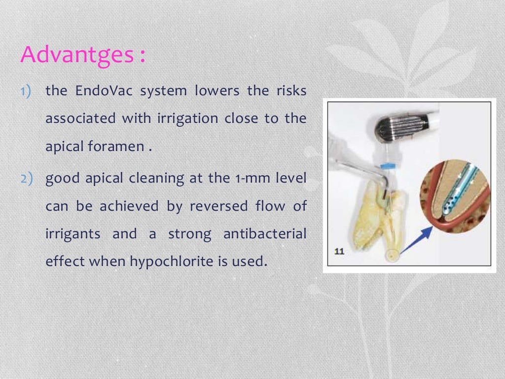 Endodontic irrigation