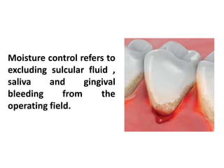 2. What needs to be
controlled during endodontic
treatment?
a. Saliva
b. Tongue
c. Mandible
d. Lips & cheek
e.Gingival tis...