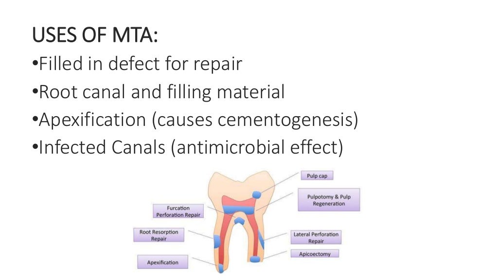 Endodontic materials