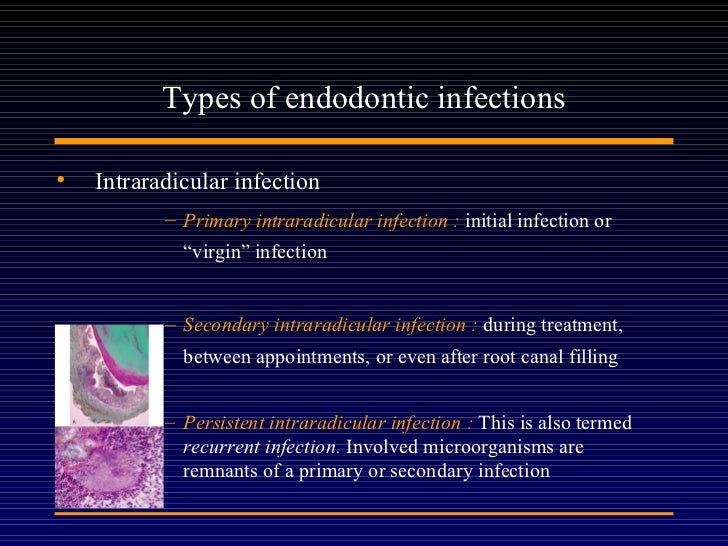 Endodontic microbiology