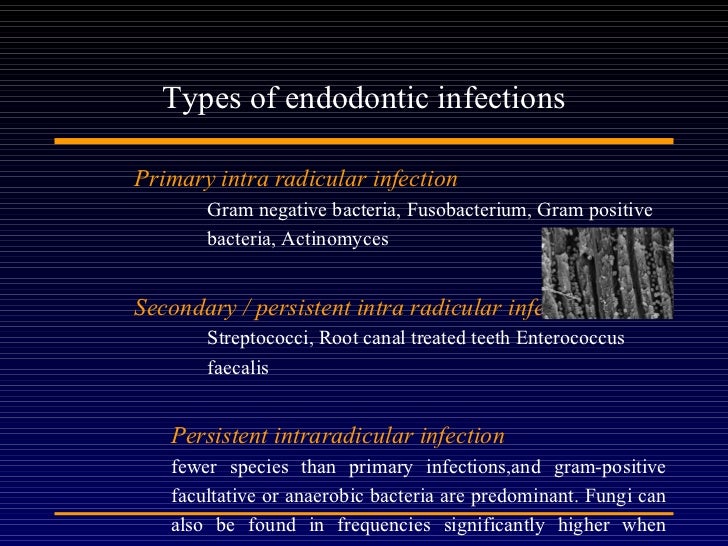 Endodontic microbiology