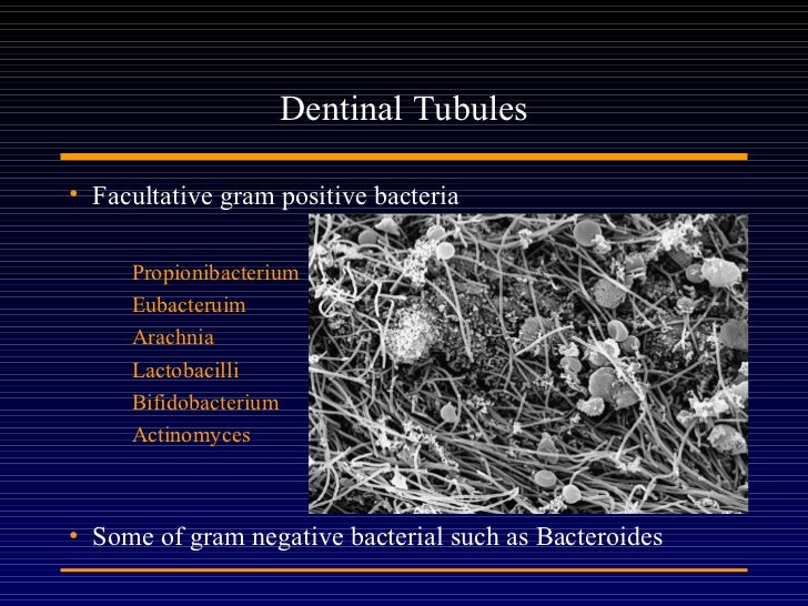 Endodontic microbiology