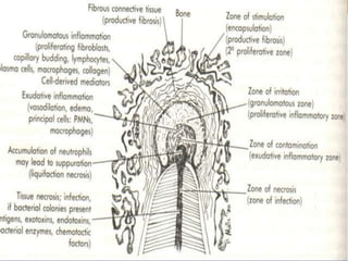 Who found co relation???
• W D MILLER
• FISH ZONE (1939)
 