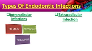 Types Of Endodontic Infections
Intraradicular
Infections
Extraradicular
Infection
 