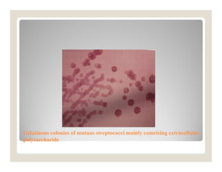 Endodontic microflora