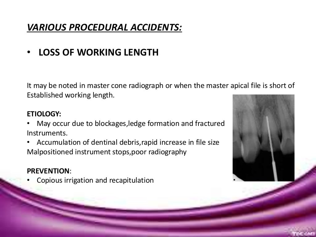 Endodontic mishaps/PROCEDURAL ACCIDENTS