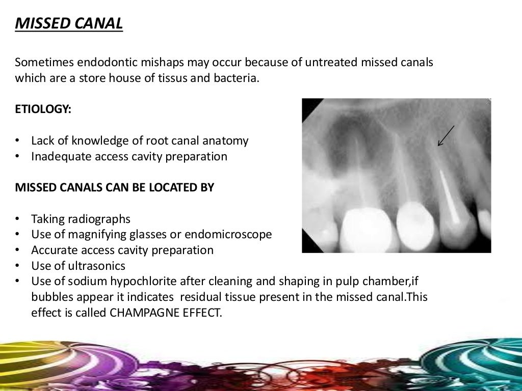 Endodontic mishaps/PROCEDURAL ACCIDENTS