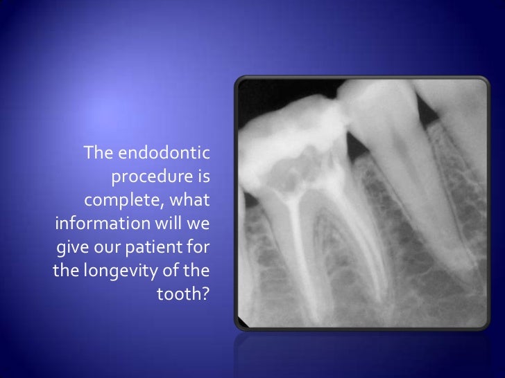 Endodontic quiz