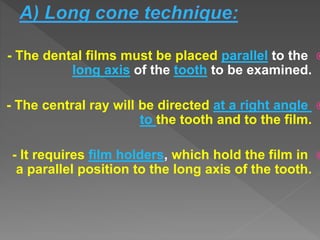 - The dental films must be placed parallel to the
long axis of the tooth to be examined.
- The central ray will be directed at a right angle
to the tooth and to the film.
- It requires film holders, which hold the film in
a parallel position to the long axis of the tooth.
 