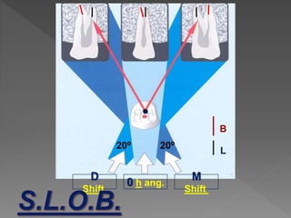0 h ang.
M
Shift
D
Shift
B
L
20⁰20⁰
 