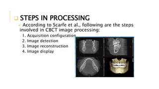  STEPS IN PROCESSING
 According to Scarfe et al., following are the steps
involved in CBCT image processing:
1. Acquisition configuration
2. Image detection
3. Image reconstruction
4. Image display
 