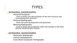 TYPES
 INTRAORAL RADIOGRAPHS
•Intraoral Periapical
 Used to detect any abnormalities of the root structure and
surrounding bone structure
•Occlusal Radiographs
 Show full tooth development and placement
•Bitewing Radiographs
 Used to detect decay between teeth and changes in the bone
density caused by gum disease
 EXTRAORAL RADIOGRAPHS
•Panoramic Radiograph
•Lateral Cephalograms
•Cone Beam Computed Tomography
 