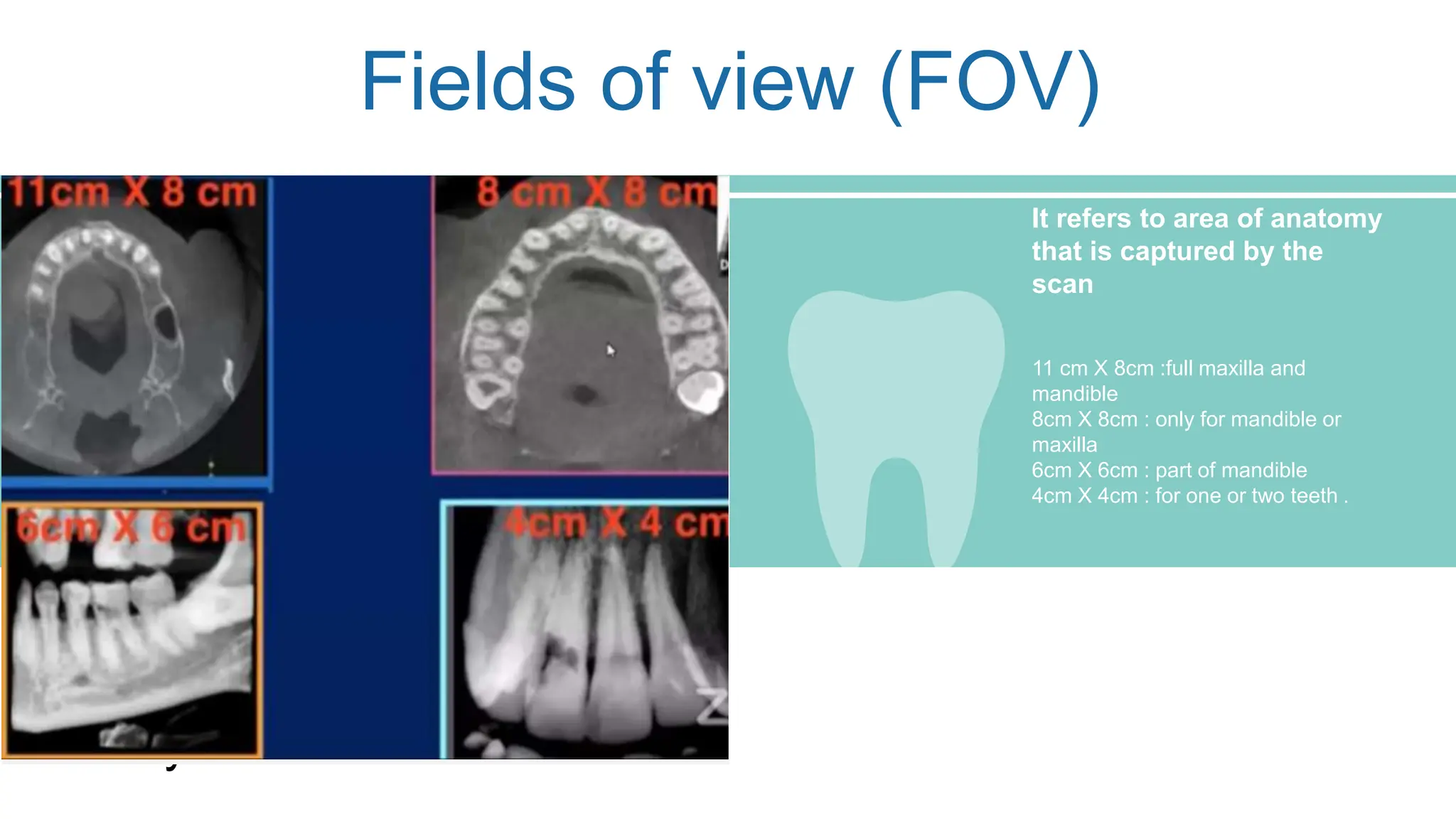 Visualization Endogram Endodontic radiography.................. | PPTX