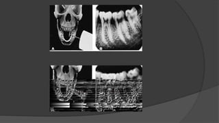 Visualization Endogram Endodontic radiography.................. | PPTX
